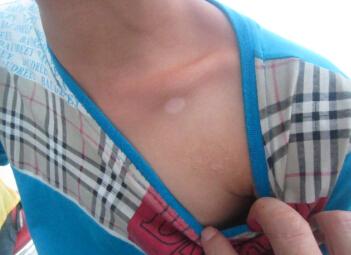 ϾõİҽԺ?ڰ֢״